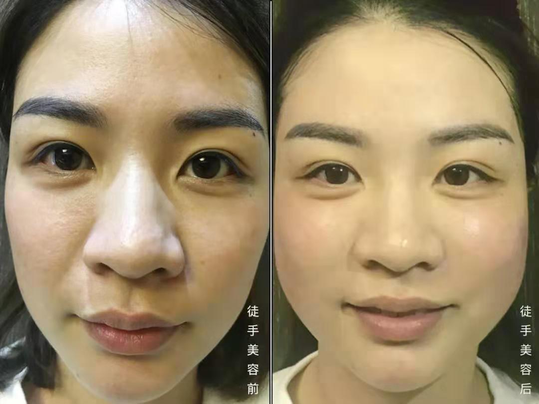 1552474187282981.jpg 微信图片_20190313184911.jpg